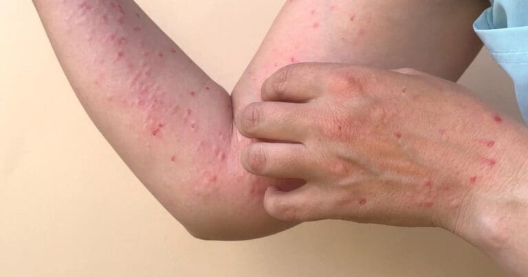 1200x630 Skin rashes