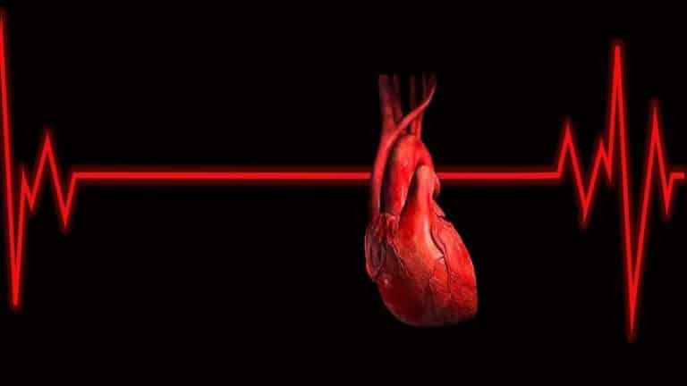 Heart Attack