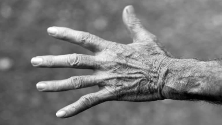 Parkinson 21