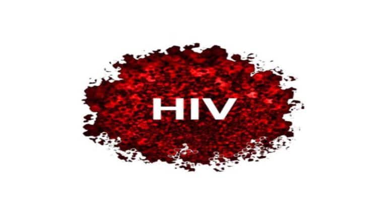 HIV לאתר