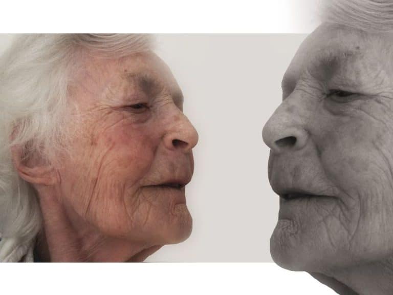 Alzheimer6
