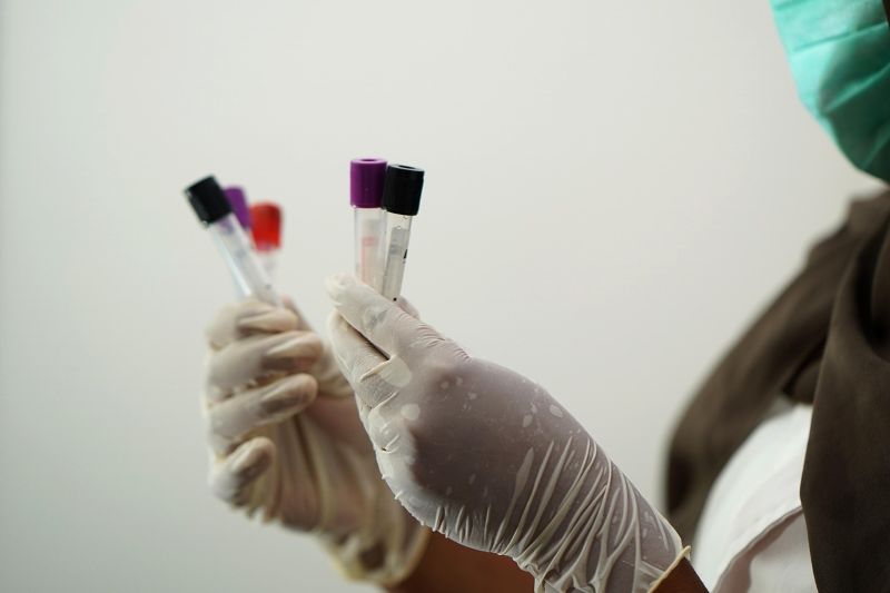 Urine test17