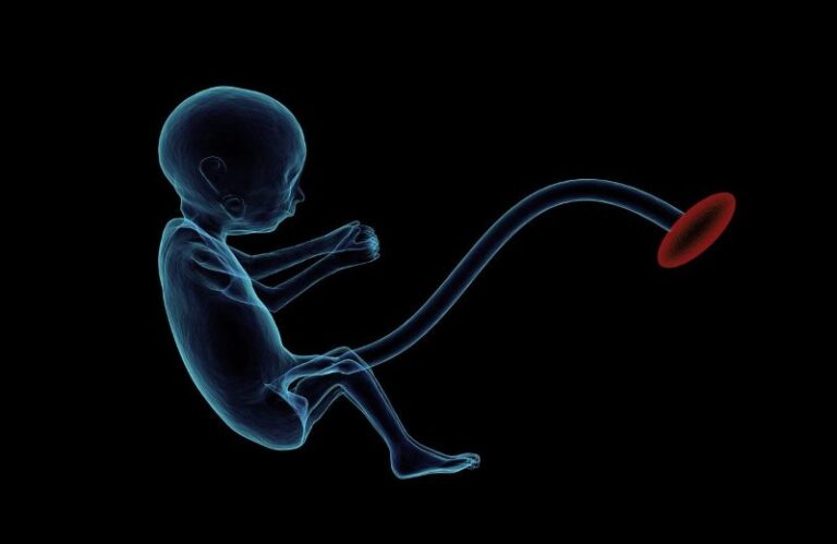 fetus